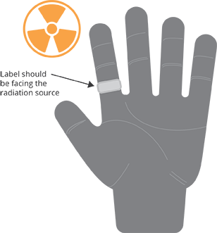 hand with dosimeter ring
