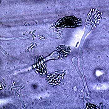 Aspergillus restrictus