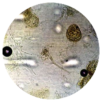 Aspergillus glaucus (Eurotium spp.)
