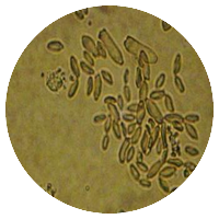 Cladosporium spp. (Hormodendrum spp.)