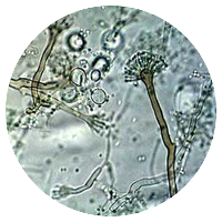 Aspergillus nidulans (Emericella spp.)